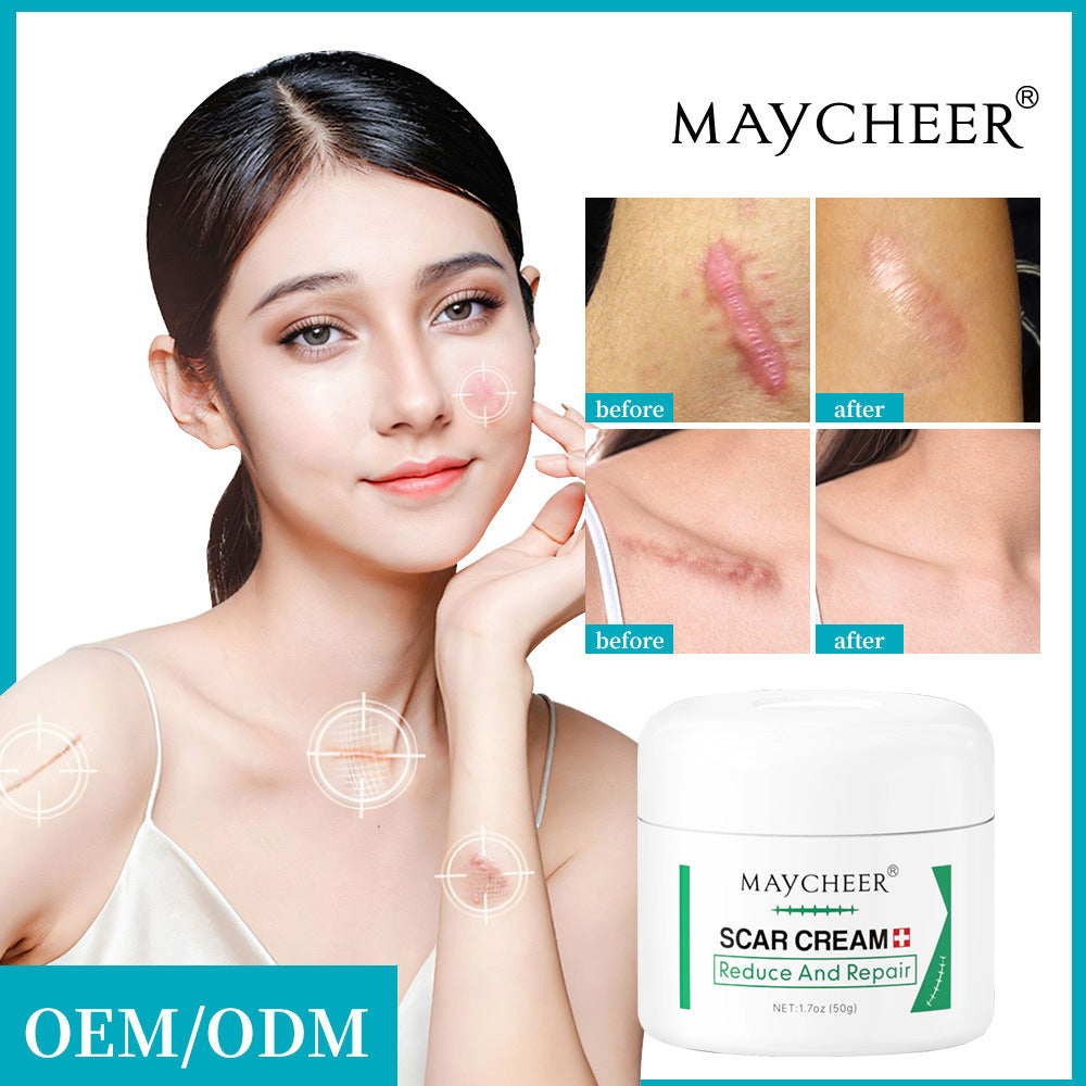 MAYCHEER® Body Scar Repair Cream 50G(1.7oz)